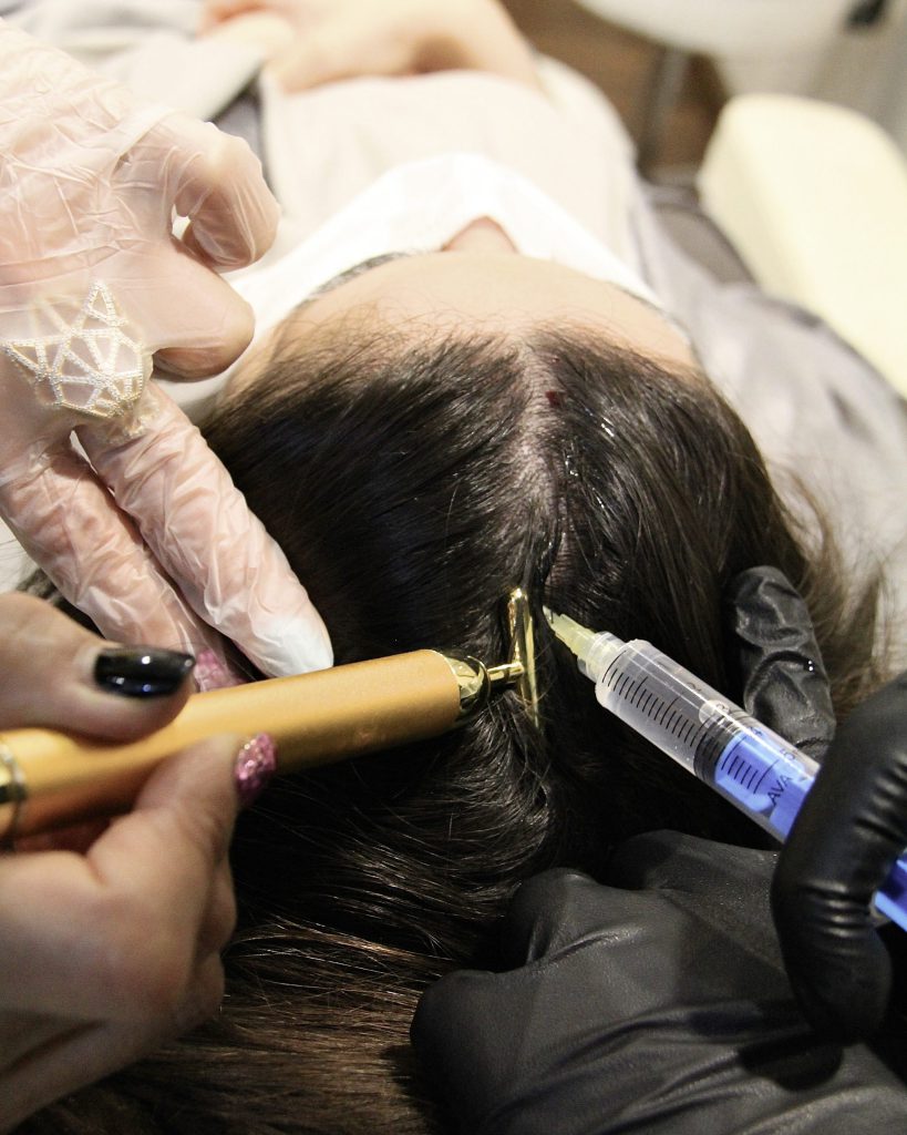 علل ریزش موی بانوان، روش های پیشگیری و درمان
