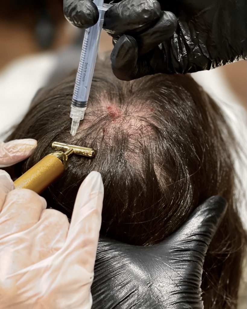 ریزش موی ارثی، روش های پیشگیری و درمان