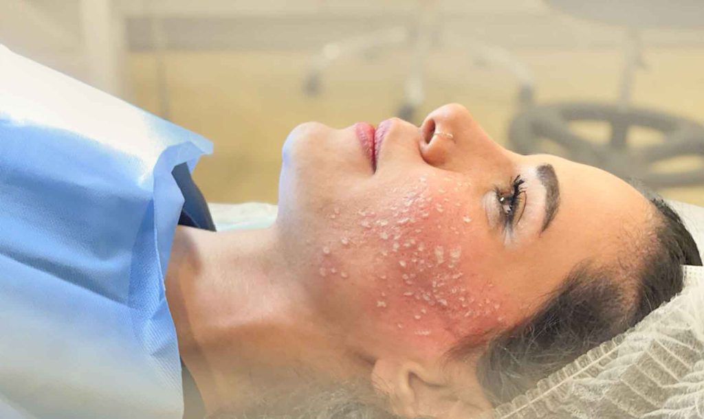 درمان بیماری های پوستی